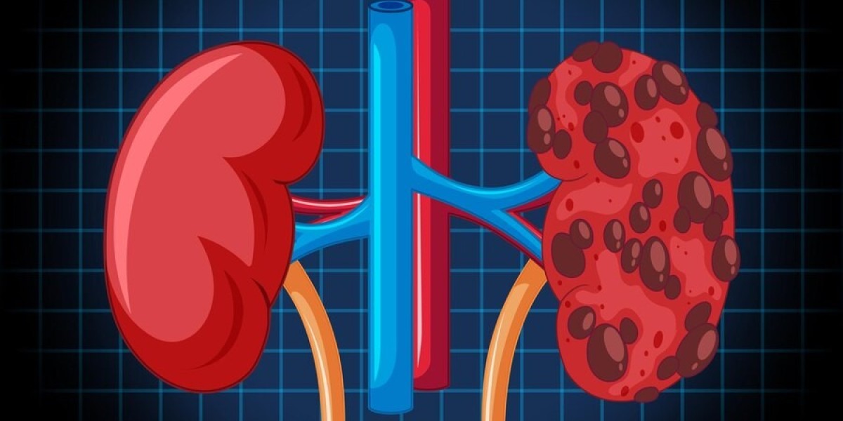 Singapore Renal Denervation Market: Trends, Growth Insights, and Future Prospects