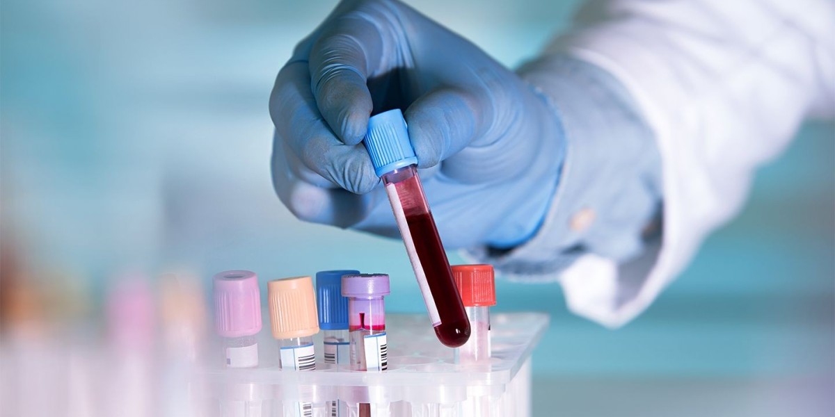 Liquid Biopsy Market: Trends, Growth Opportunities, and Future Outlook