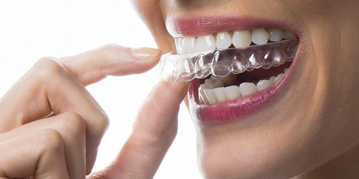 Make Perfect Straight Teeth with Teeth Aligners in Mitcham