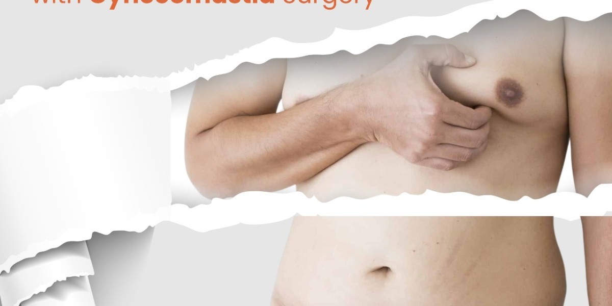 Gynecomastia Surgery Cost in Hyderabad