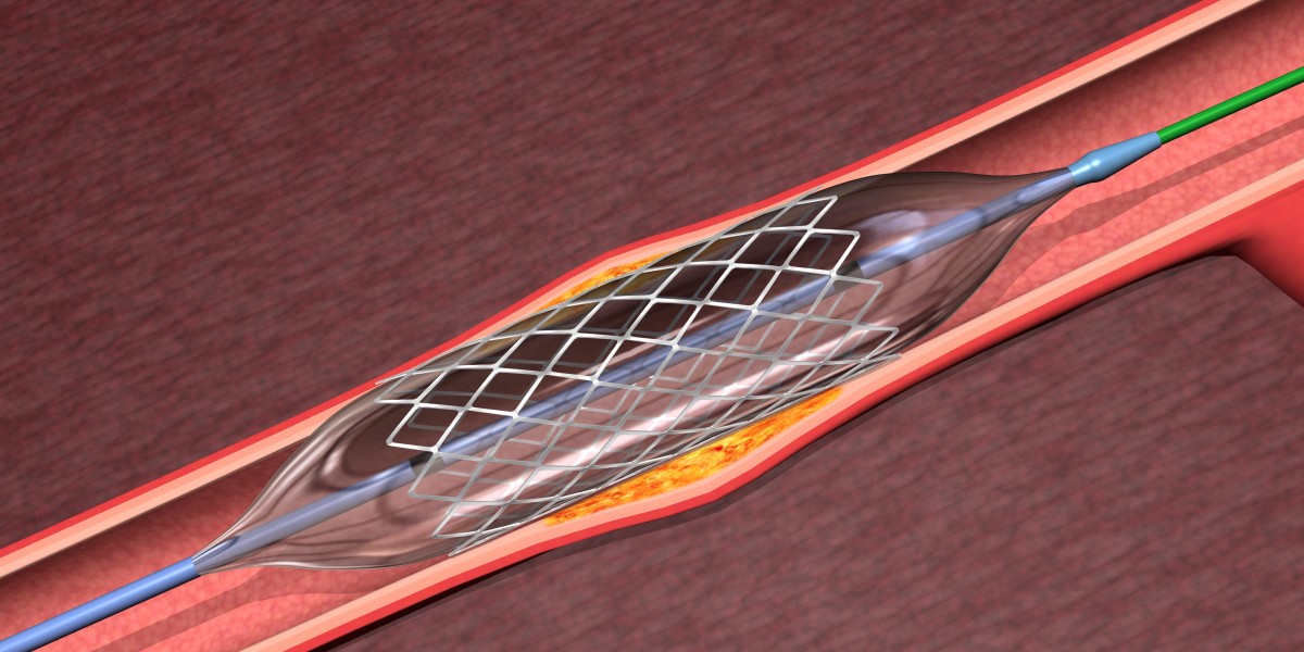 Angioplasty Balloons Market Pain Points Hindering Widespread Adoption and Access