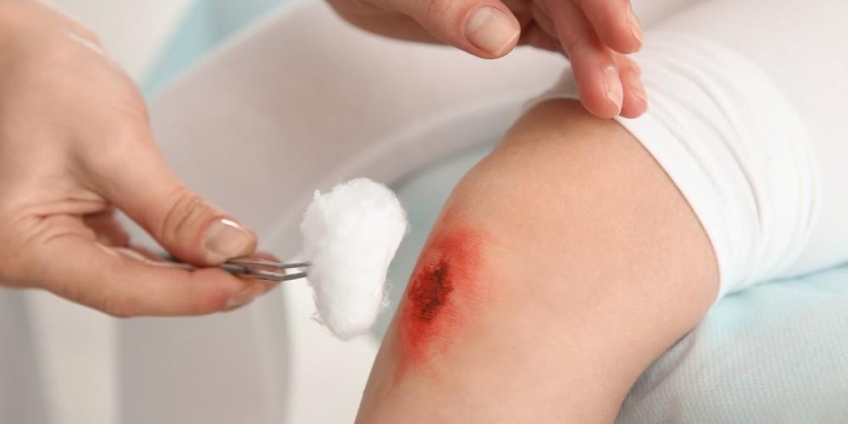 Wound Care Biologics Market: Transforming Healing in the 21st Century