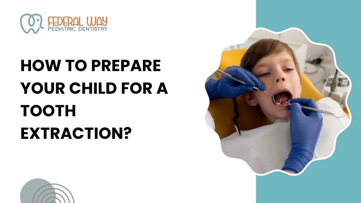 PPT - How to Prepare Your Child for a Tooth Extraction PowerPoint Presentation - ID:14006963