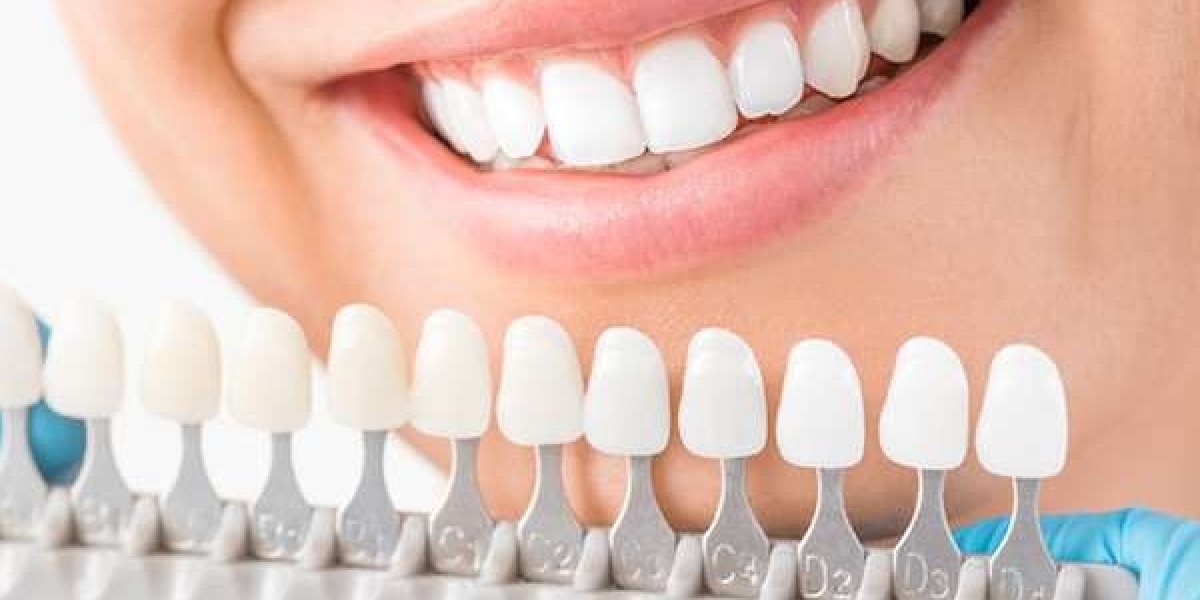 Top 10 Tips for a Radiant Smile Through Cosmetic Dentistry