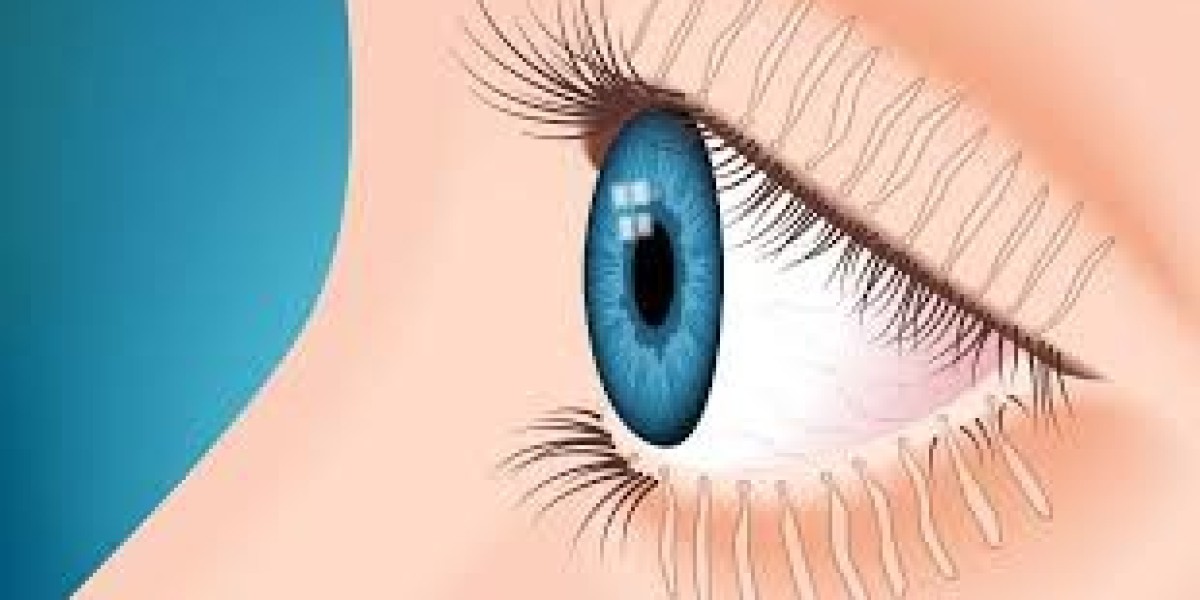 Effective Strategies for Managing Blepharitis: From Home Remedies to Medical Treatments