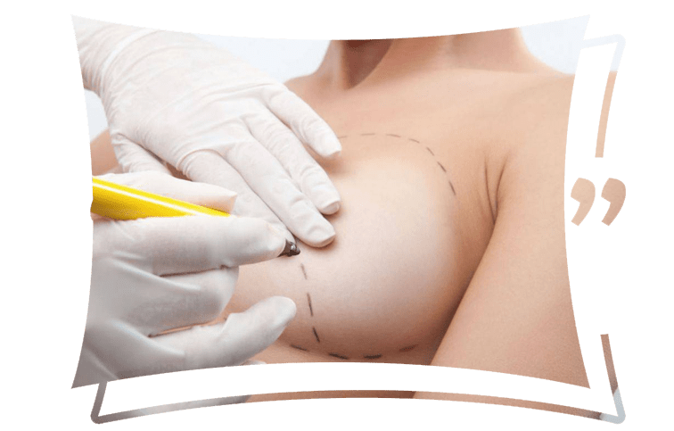 Breast Surgery in Dubai & Abu Dhabi | Female Breast Surgeon