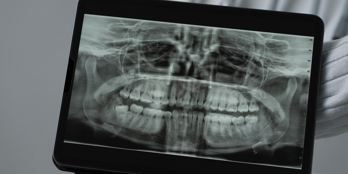 The Growing Dental Radiography Market – Insights and Trends