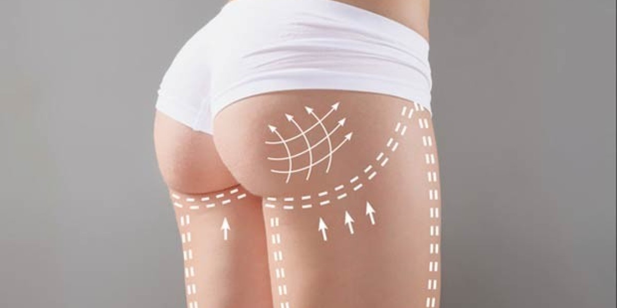 The Stunning Benefits of Butt Filler Injections in Dubai You Won’t Want to Miss