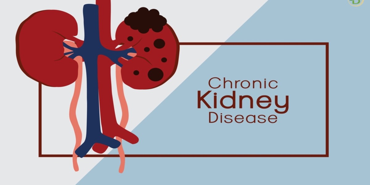 Bharat Homeopathy: Holistic Treatment for Chronic Kidney Disease & High Creatinine – A Natural Cure Without Dialysis