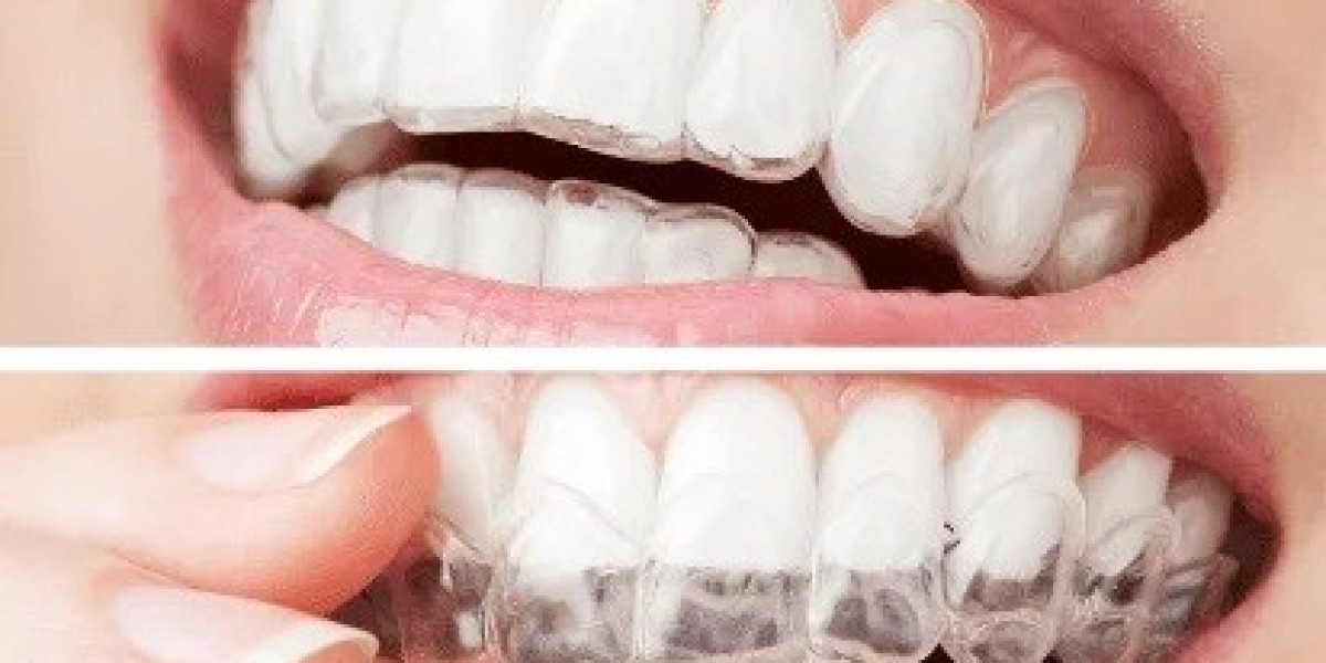 Invisalign For Adults: Is It Too Late For A Straighter Smile?