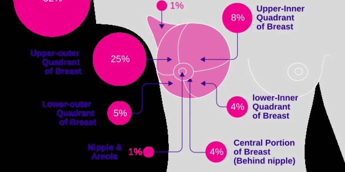 The Road Ahead: Lynparza’s Vision for the Future of Breast Cancer Care