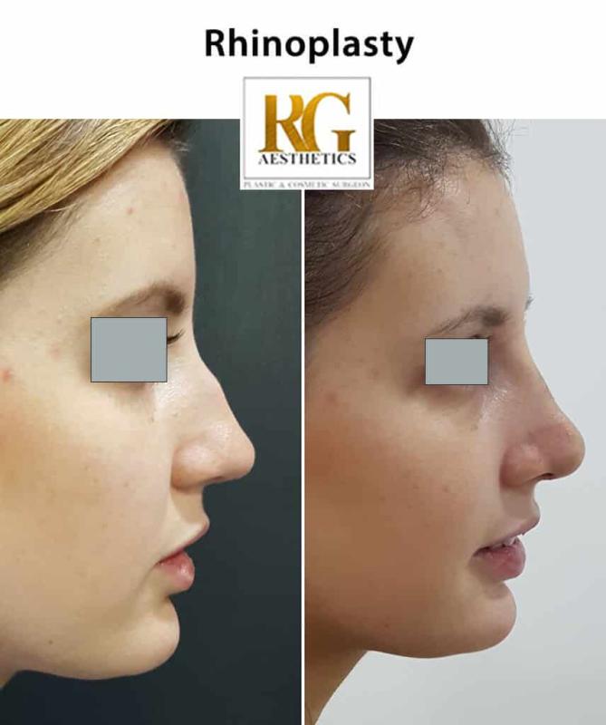 Top 5 Cosmetic Surgery Procedures That Can Boost Your Confidence | APSense.com