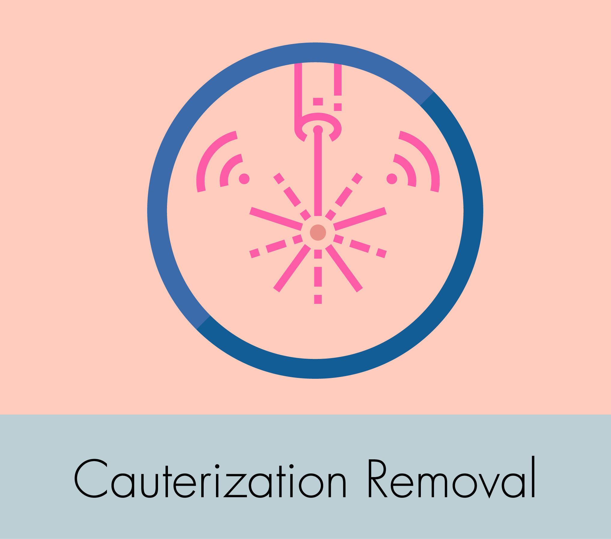 Skin Tags & Milia Removal (Cauterization): Effortless, Painless, Minimizing Scarring - MedicDeno Skin Solutions