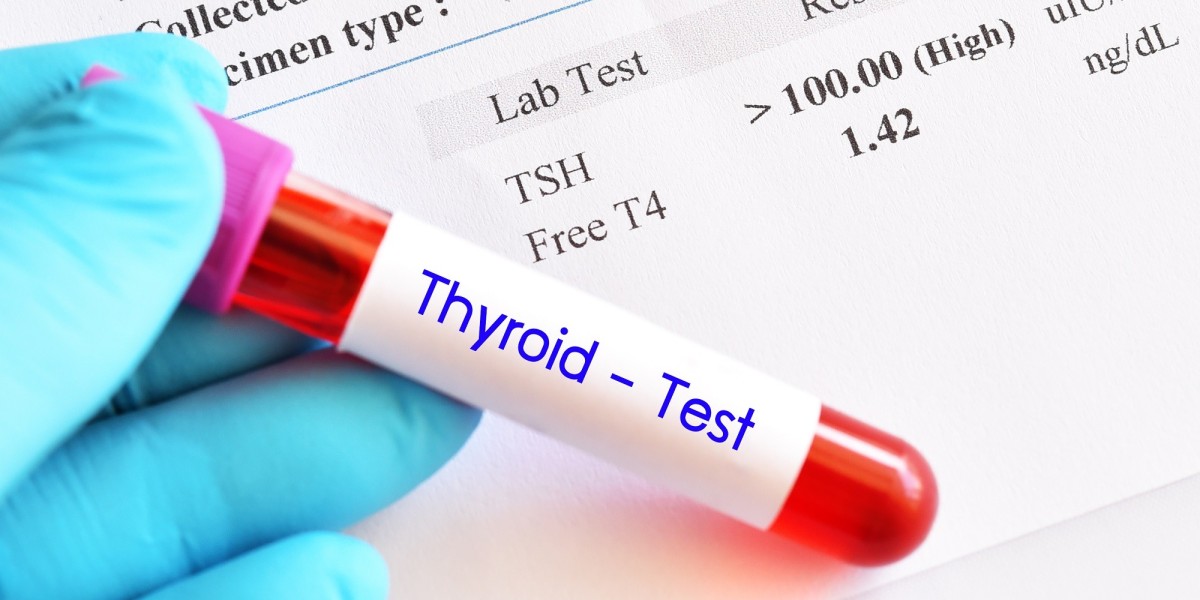 Thyroid Function Test Market Threats Hindering Adoption and Accessibility of Diagnostic Services Worldwide