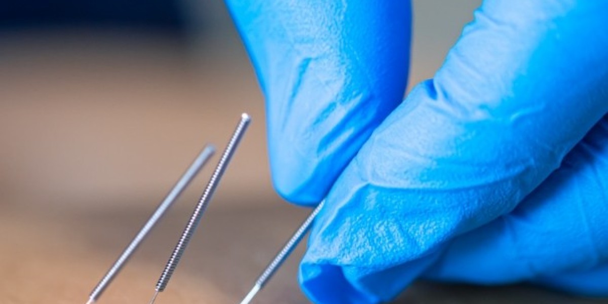 How Needling Therapy Can Help You Avoid Surgery and Heal Naturally!