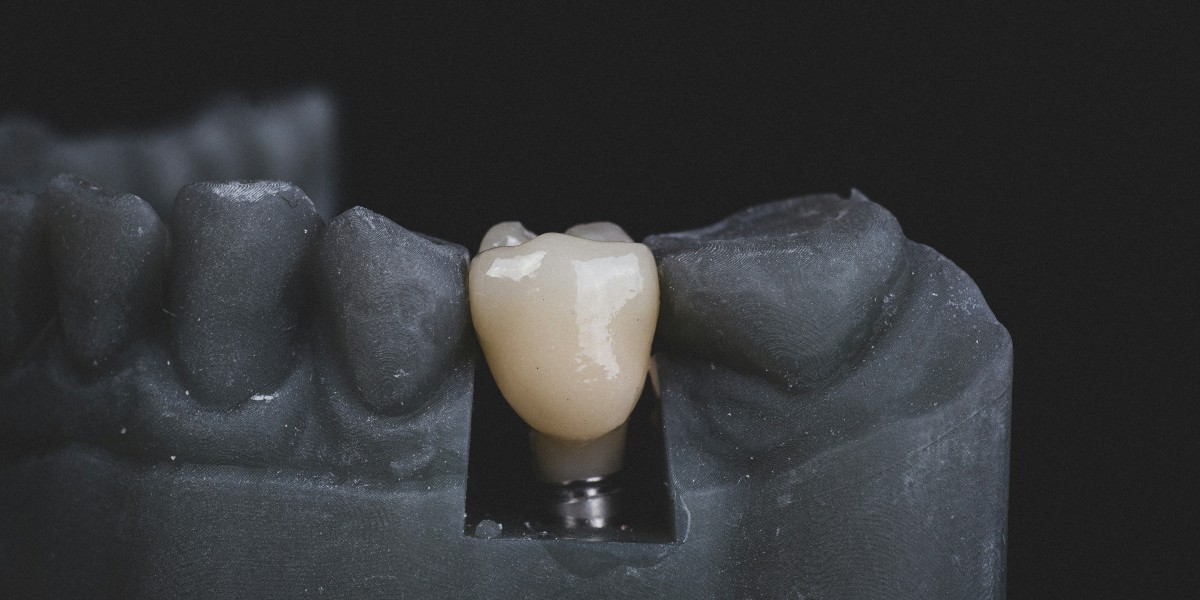 Dental Implants Market Size, Share, Growth Factors and Forecast 2025-2032