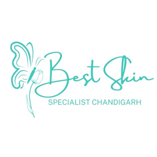 Best Skin Specialist Chandigarh