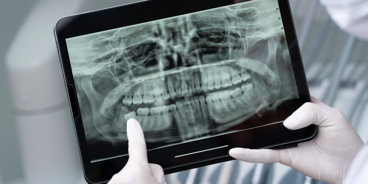 Unveiling the Growth Trajectory of Spain's Digital X-Ray Market