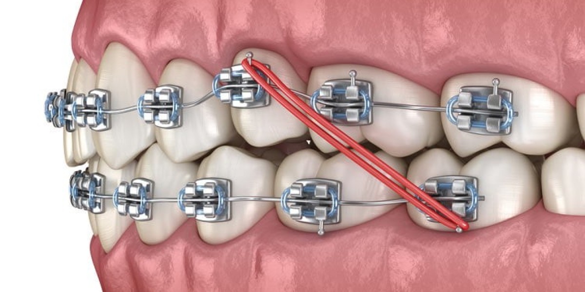 Orthodontics Market: Growth Trends, Key Drivers, and Future Outlook