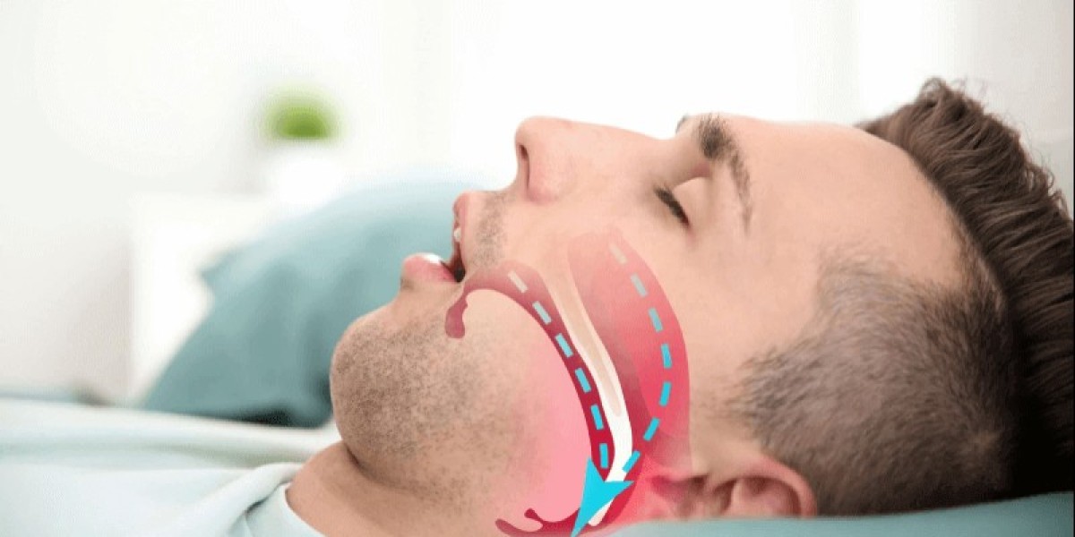 How Sleep Apnea Affects Your Quality of Life and Daily Activities