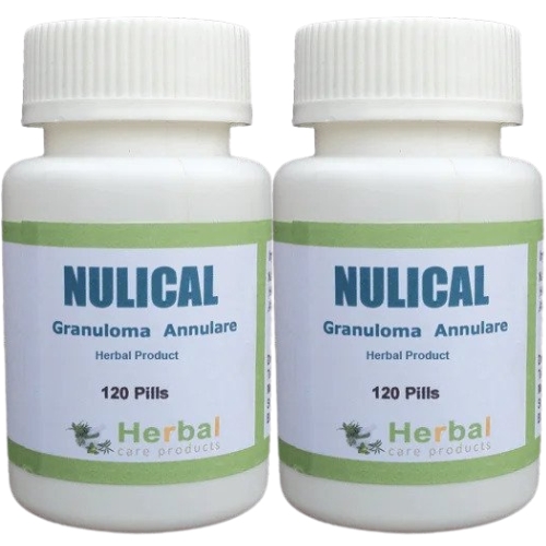 Nulical Herbal Supplement for Granuloma Annulare