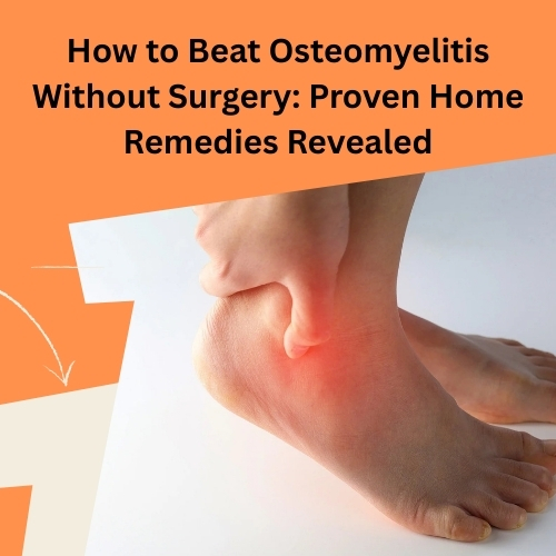 How to Beat Osteomyelitis Without Surgery: Proven Home Remedies Revealed – Natural Herbal Supplements