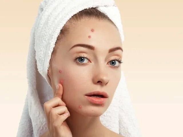 Tired of Wrinkles? Face Treatments in Terrebonne Can Help - guest-post.org