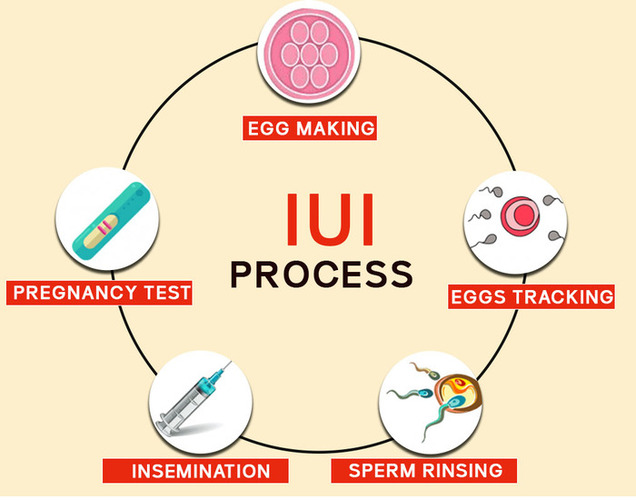 Best IUI Treatment Specialist In New Delhi, Dr. Rupali Bassi