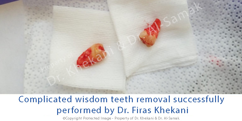 General Dentistry Services in Hamilton | Red Rose Dentistry