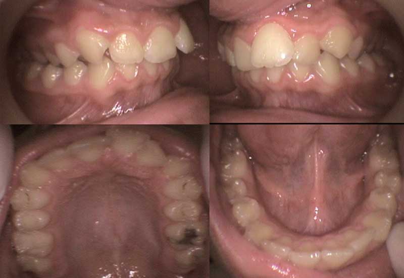 Dental Case Studies | Red Rose Dentistry