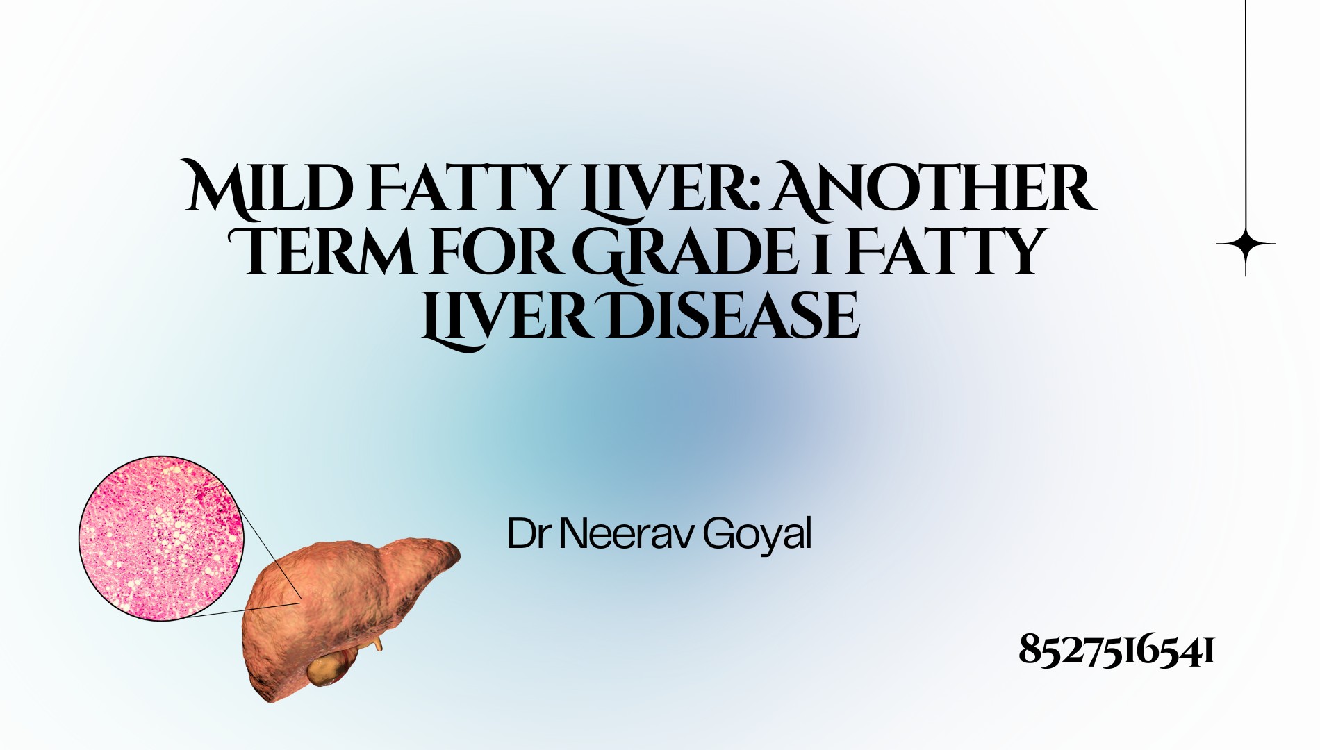 Neerav Goyal