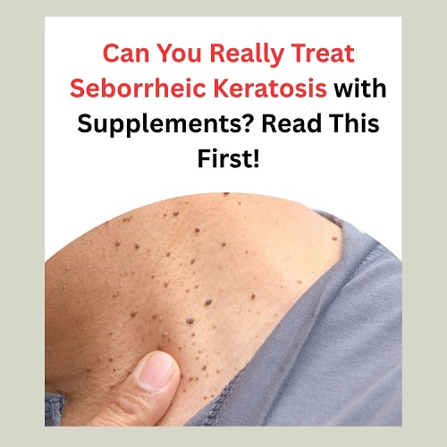 Can You Really Treat Seborrheic Keratosis with Supplements? Read This First! - Herbal Care Products - Blog