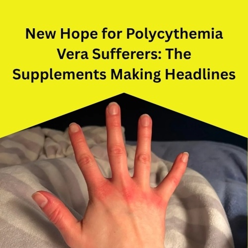 New Hope for Polycythemia Vera Sufferers: The Supplements Making Headlines - Natural Health News