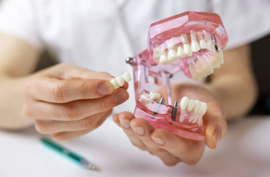 Dental Implants in Whitefield | Best dentist for implant
