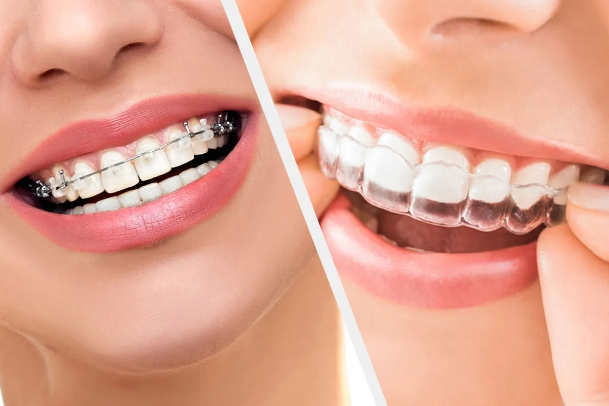 Orthodontist Doctor in RR Nagar – Site Title
