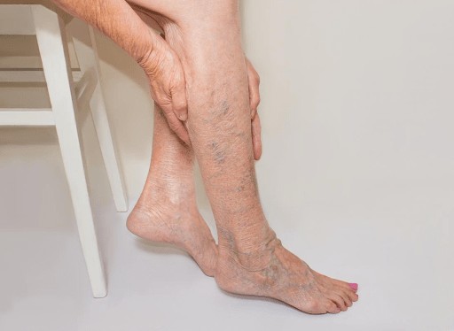 VenovixilVein VenovixilVein