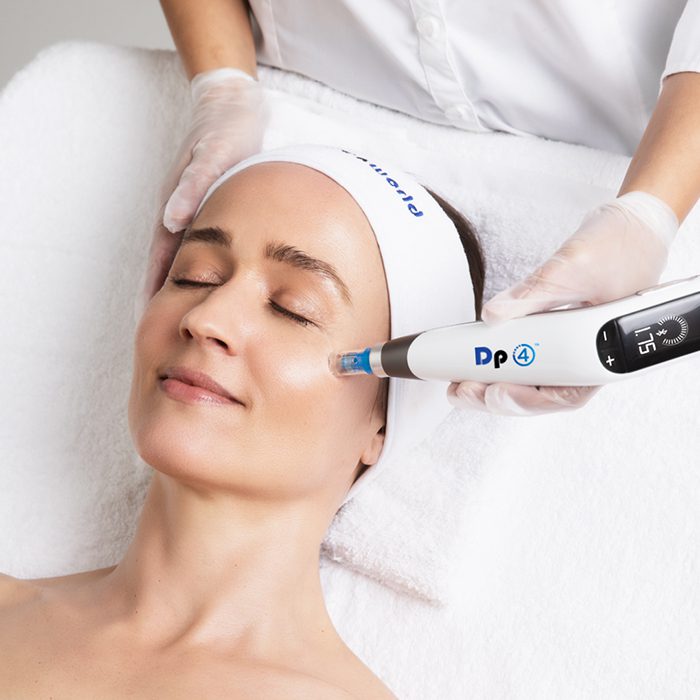 Microneedling - Nebula Wellness