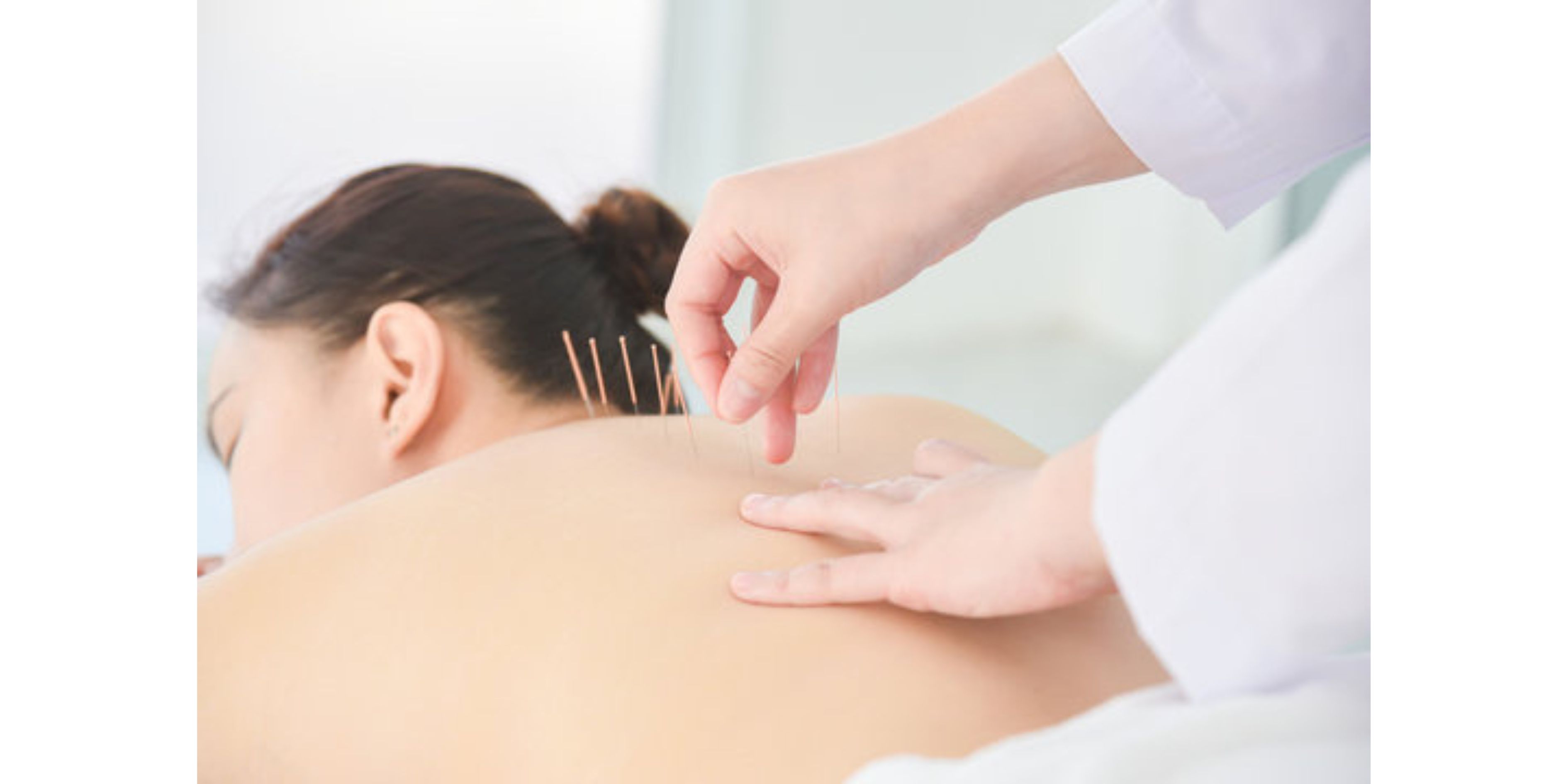 Whizolosophy | Boost Your Immune System This Season with Acupuncture