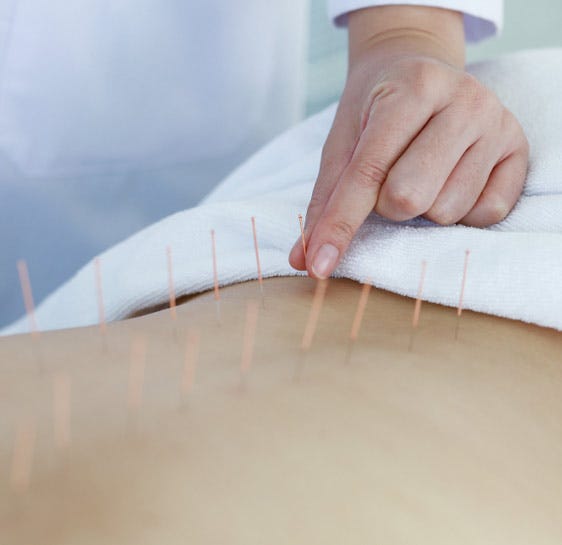 The Healing Power of Acupuncture and Natural Therapies in RR Nagar | by Bhadramnaturesclinic | Oct, 2025 | Medium