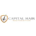 Capital Hair Restoration