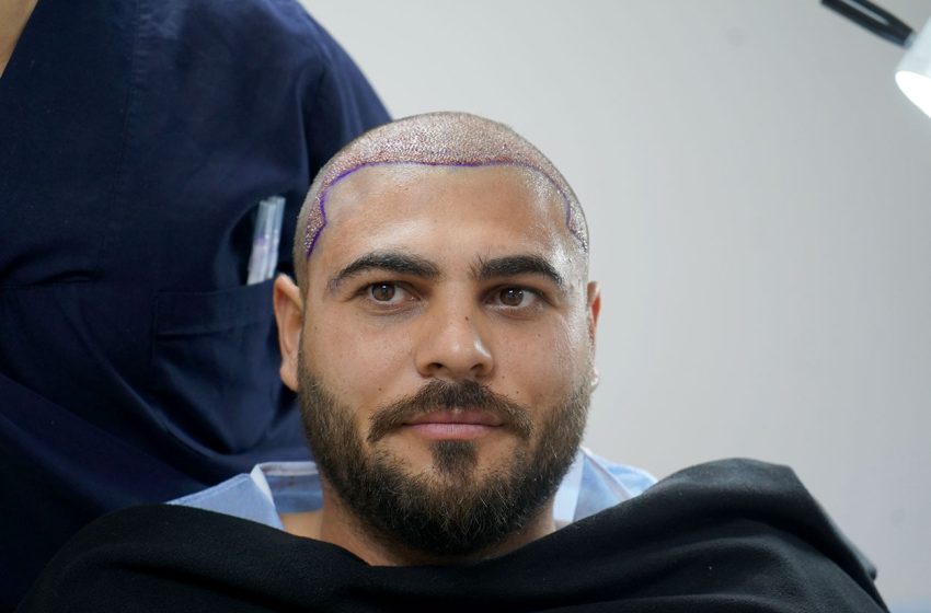 Sapphire Hair Transplant Turkey Explained: Procedure, Benefits, and Results – Webs Article