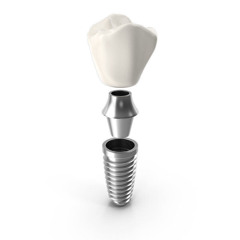 Dental Implants in Somerville, NJ | Somerset Oral Surgery