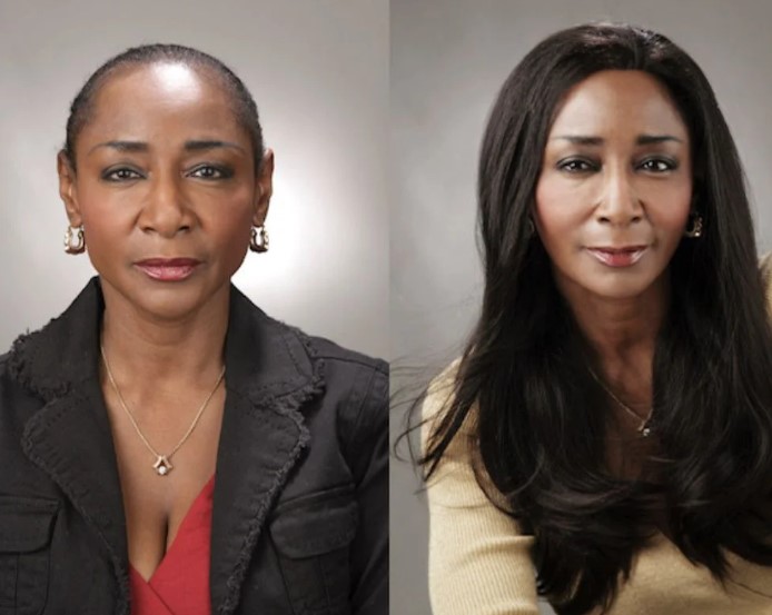 World Hair Institute Leads the Way in Advanced Non-Surgical Hair Restoration Solutions -  WriteUpCafe